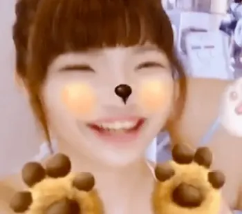ちゅきメロディ 整形前