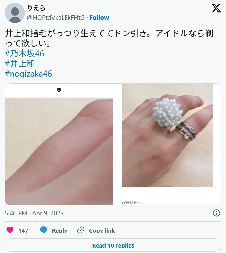 井上和の指毛と脇の噂まとめ｜拡散の経緯とファンの反応を徹底検証